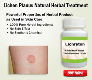 Natural Treatment for Lichen Planus to Reduce Pain and Swelling Quickly