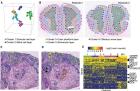 The Secrets Of Tissues with Spatial Transcriptomics