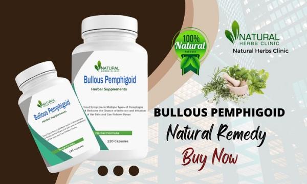 Buy Best Natural Remedy for Bullous Pemphigoid Natural Treatment
