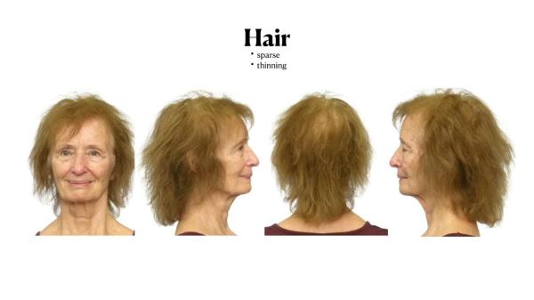 Susanne's Age-Defying Makeover: From 78 to Looking Great!