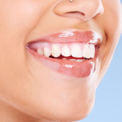 Teeth Whitening and Straightening
