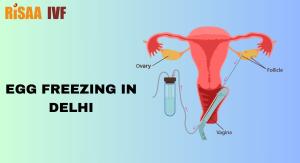 Egg Freezing in Delhi - Preserve Your Future Fertility with Risaa IVF
