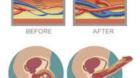 Erectile Dysfunction Treatment Near Me