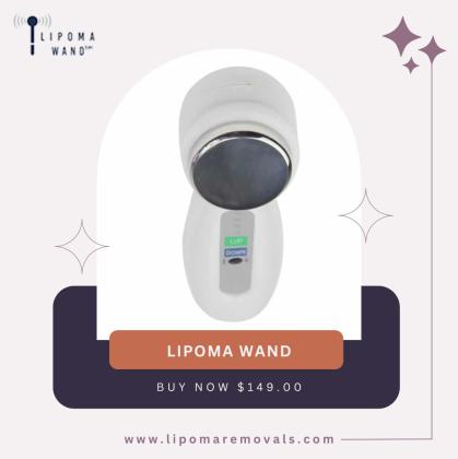 Natural Lipoma Treatment Heal Without Surgery