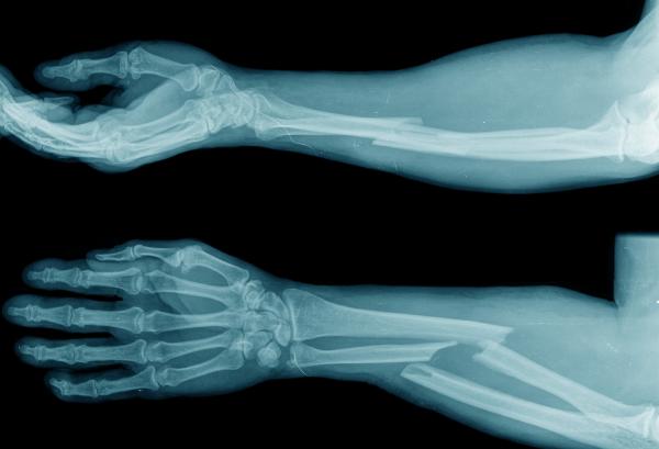 Best Ortho surgeon in Madurai