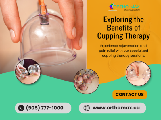 Cupping Hamilton