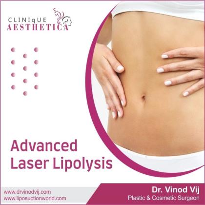 Expert Laser Lipolysis and Liposuction in Navi Mumbai: Dr. Vinod Vij