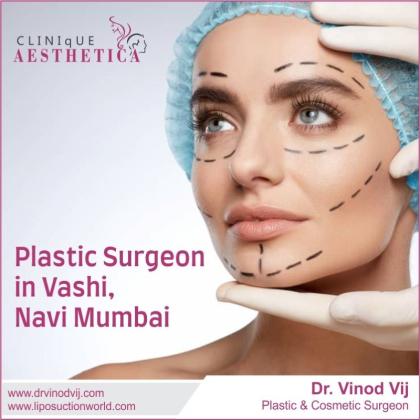 Meet Dr. Vinod Vij: Premier Plastic Surgeon in Vashi, Navi Mumbai