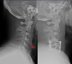 Ortho Hospital in Madurai   Taj Orthopaedic Research Centre (TORC) is a referral Best Ortho Hospital in Madurai with wide-ranging facilities and a ded