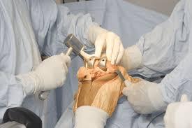 Ortho surgeon in Madurai