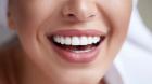 Teeth Whitening