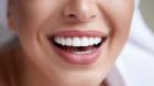 Teeth Whitening In Raleigh