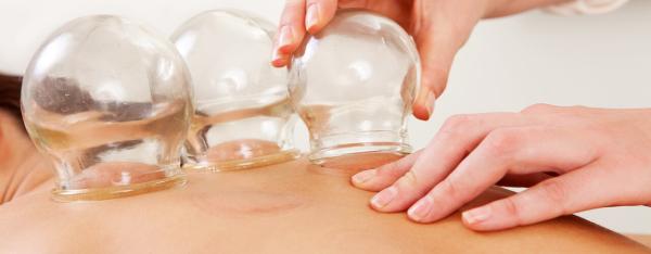 Cupping NYC