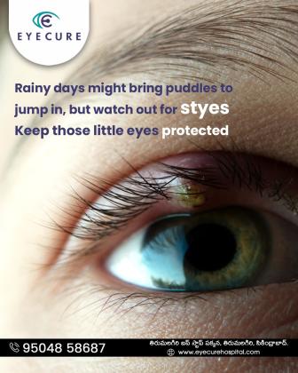 Eye hospital in secunderabad