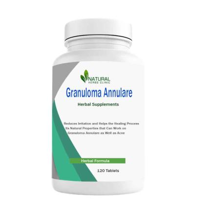 Herbal Supplement for Granuloma Annulare