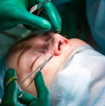 Rhinoplasty Nose Surgery in Punjab