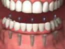 Advanced Dentistry of Coral Springs