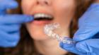 Invisalign Raleigh NC