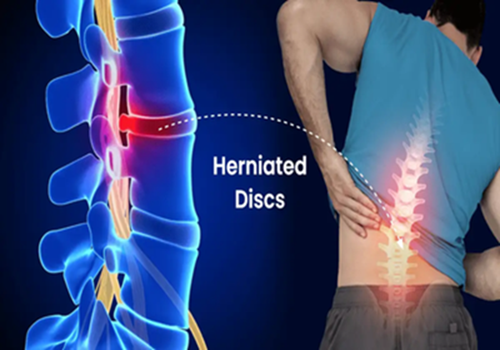 New York’s Trusted Pain Specialist Doctor for Advanced Spine and Joint Care