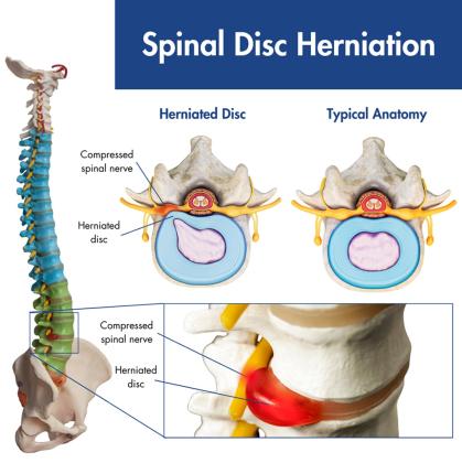 New York’s Trusted Pain Specialist Doctor for Advanced Spine and Joint Care