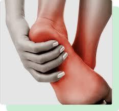 Plantar Fasciitis Heel Pain