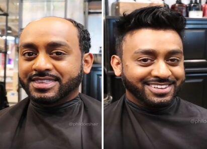 Premium Hair Wigs in Mumbai - Natural, Comfortable, and Affordable Solutions