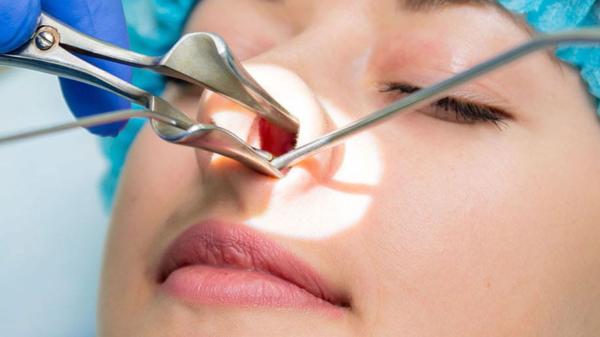 Rhinoplasty Nose Surgery In Punjab