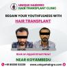 Best hair transplant clinic in tamilnadu