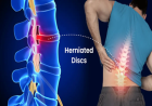 New York’s Trusted Pain Specialist Doctor for Advanced Spine and Joint Care