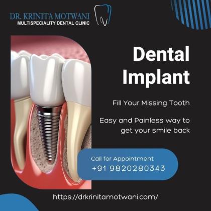Transform Your Smile with Dental Implants in Mumbai!