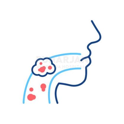 Best Oral Cancer Treatment Hospitals in Hyderabad