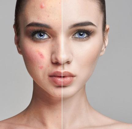 Best Skin Specialist in Dubai – Dr. Suad Lutfi Dermatology & Laser Clinic