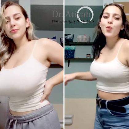 Breast augmentation Sydney