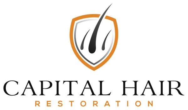 Capital Hair Restoration - Hair Transplant