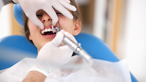 Dental Bonding for Beautiful Smiles!