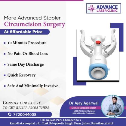 Dr Ajay Agarwal Piles Doctor, Fistula Surgeon , ZSR Circumcision, phimosis, Hernia, Gallbladder, Appendix, Pilonidal sinus