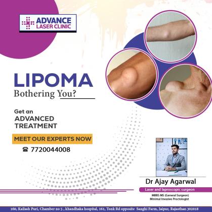 Dr Ajay Agarwal Piles Doctor, Fistula Surgeon , ZSR Circumcision, phimosis, Hernia, Gallbladder, Appendix, Pilonidal sinus