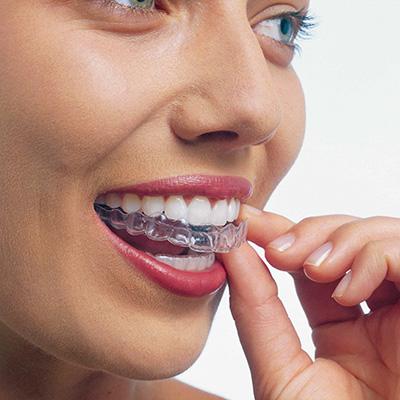 Invisalign Dental Clinic Dublin