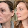 Best Plastic Surgery In Cherry Creek