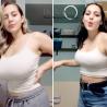 Breast augmentation Sydney