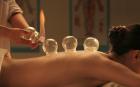 Cupping Therapy Millbrae, CA