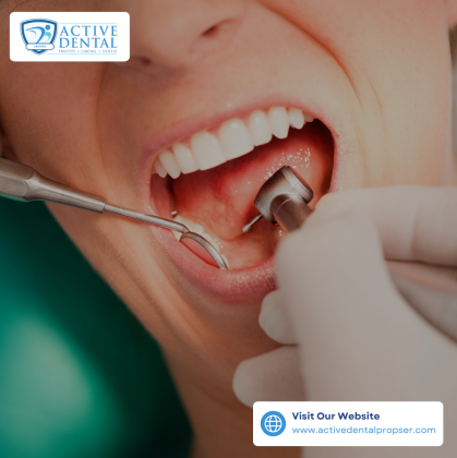Achieve a Sparkling Smile with Teeth Cleaning in Prosper!