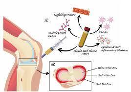 Best Female Orthopedic Doctor in hyderabad