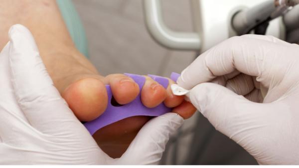 Chiropody Hamilton