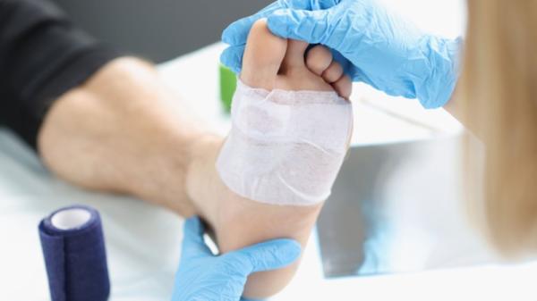 Diabetic Wound Healing