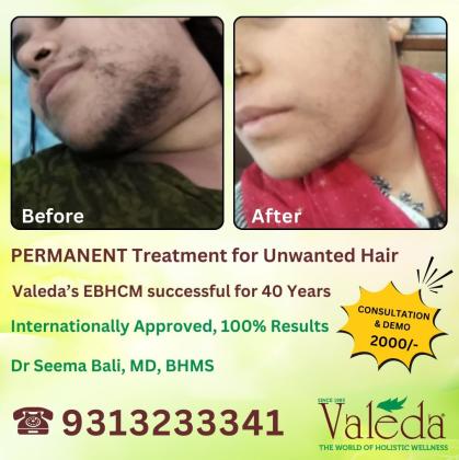 PERMANENT TREATMENT FOR UNWANTED HAIR VALEDA EBHCM