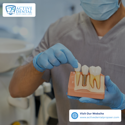 Transform Your Smile with Dental Implants in Prosper