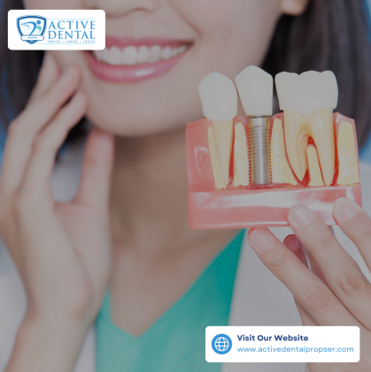 Transform Your Smile with Dental Implants in Prosper