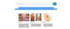 Best protruding upper teeth
