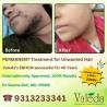 PERMANENT TREATMENT FOR UNWANTED HAIR VALEDA EBHCM
